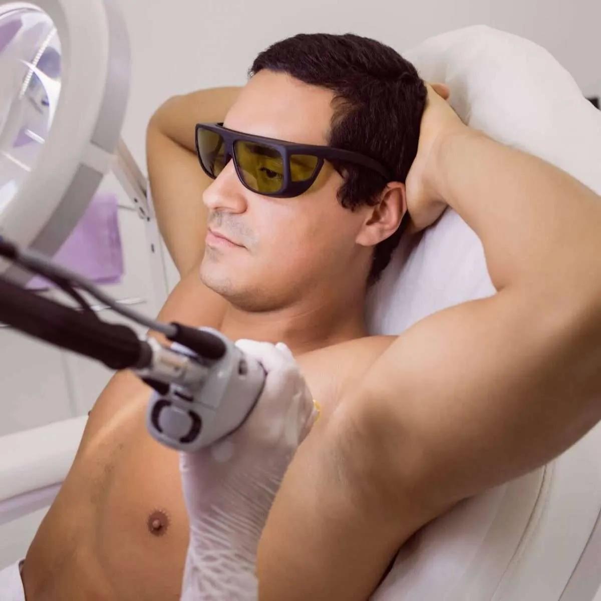 Laser Hair Removal